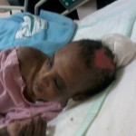 An Ethiopian torture victim in Saudi Arabia